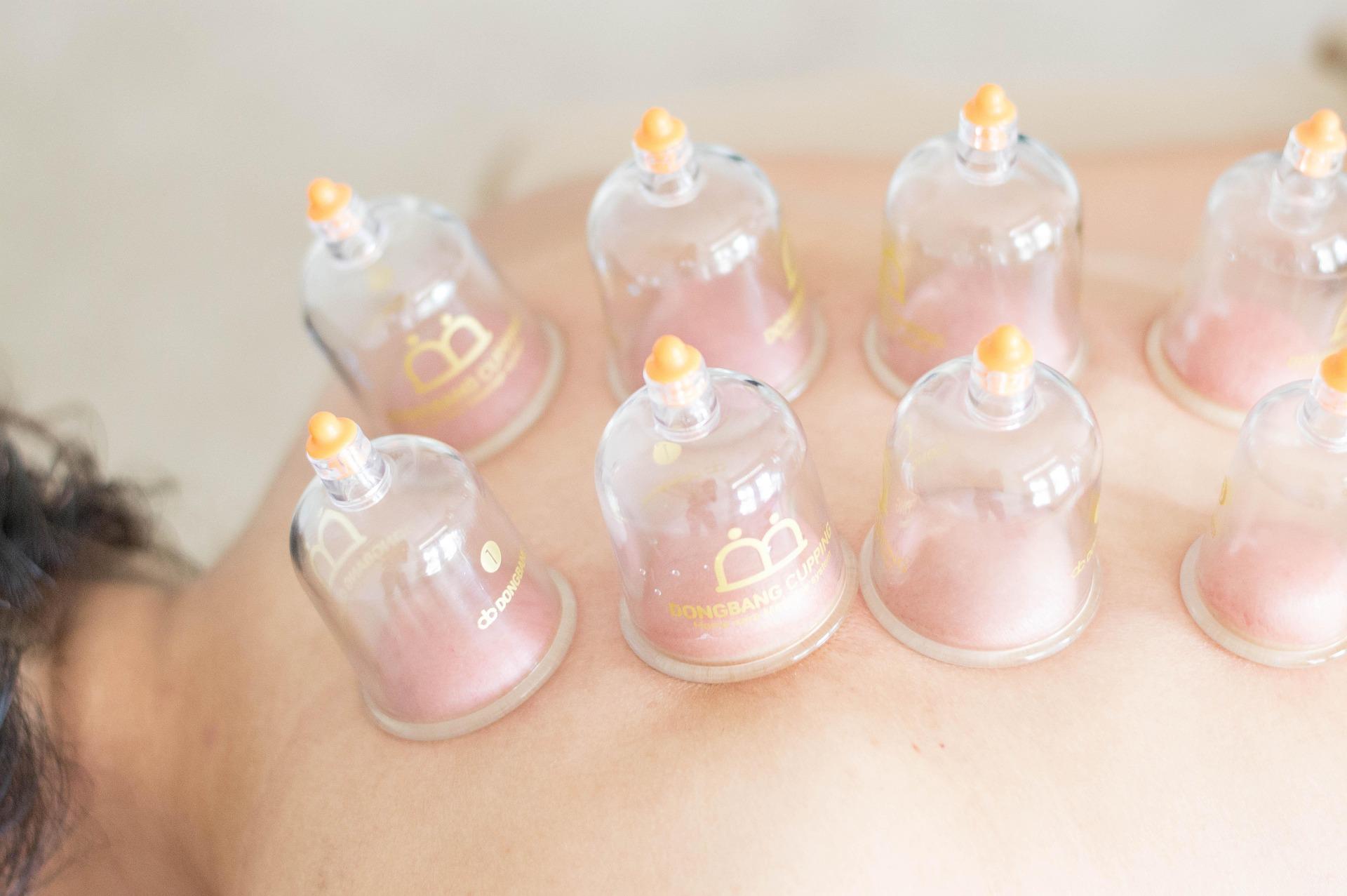 Hijama / Cupping Therapy